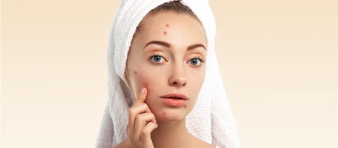 Suffering from Acne, Eczema, or Rashes